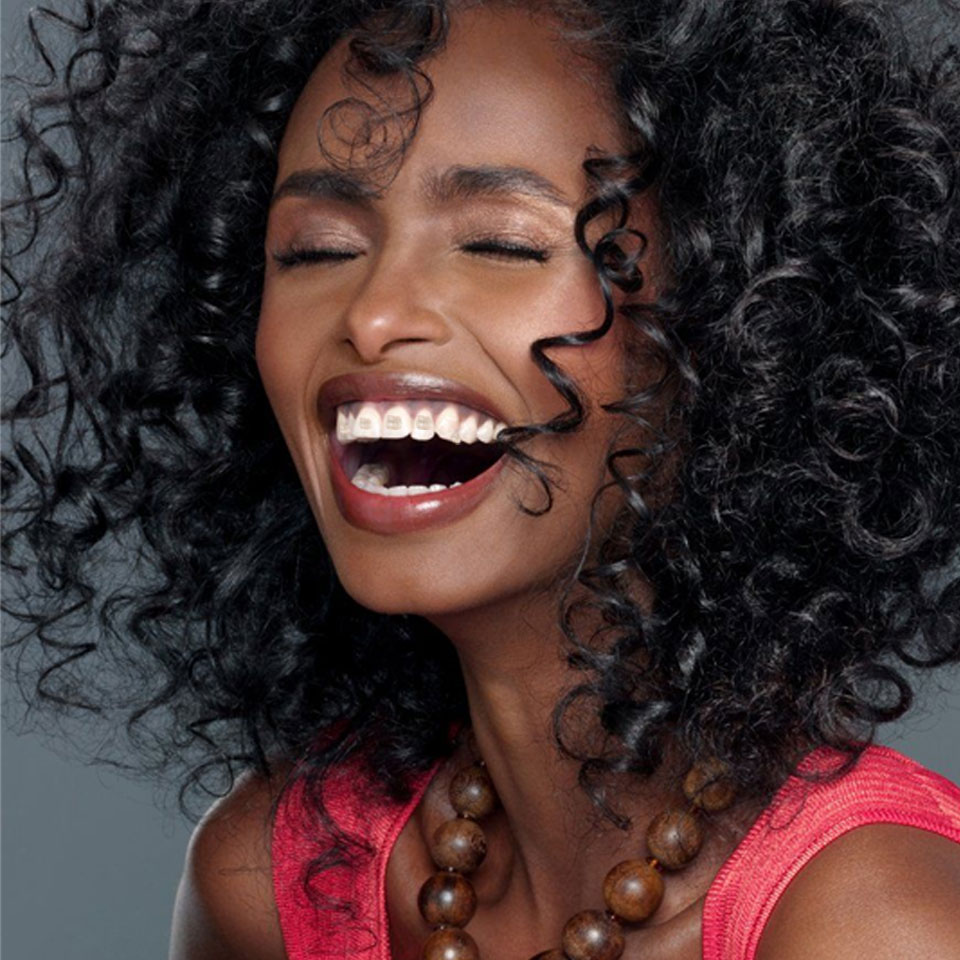 ceramic braces
