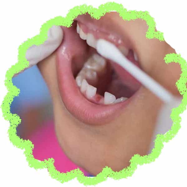 fluoride kids fluoride