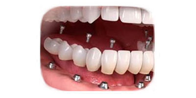 pediatric-dentist-Cai-Zhang